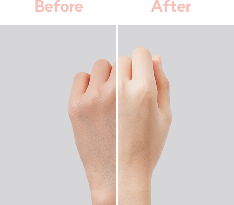 Before & After